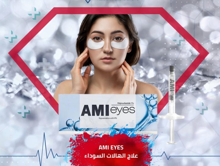 علاج الهالات السوداء AMI Eyes